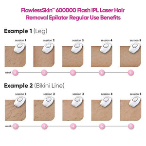 FlawlessSkin™ IPL Laser Hair Remover