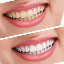 Load image into Gallery viewer, BloomVenus DazzlingSmile™ Teeth Whitening Dental Kit