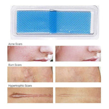 Load image into Gallery viewer, BloomVenus FLAWLESSYOU™ Stretch Mark Removal Sheet